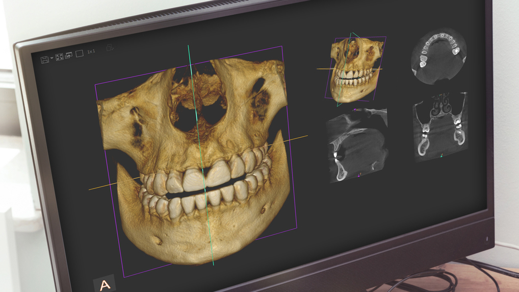 呉市中通の歯科用CT