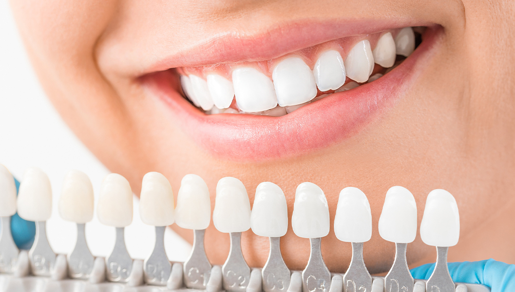 呉市中通の入れ歯治療