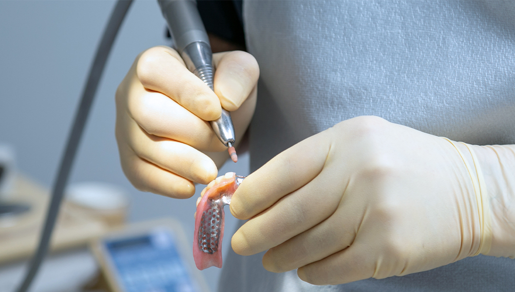 呉市中通の入れ歯治療