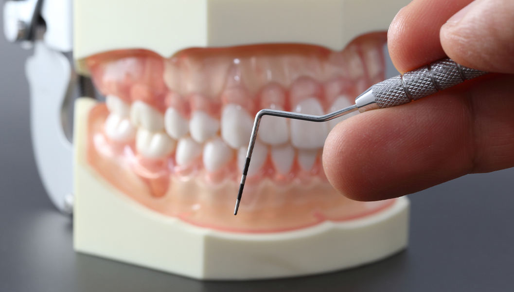 呉市中通の予防歯科・定期検診