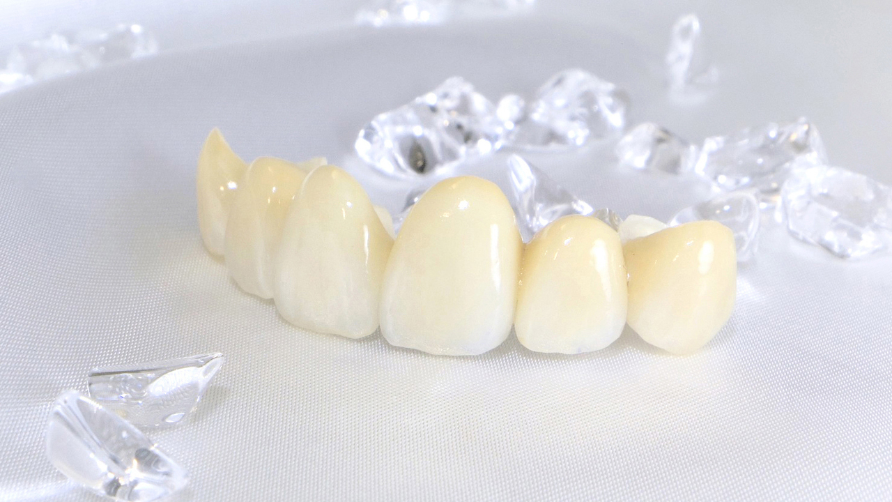 呉市中通のセレック1dayトリートメント