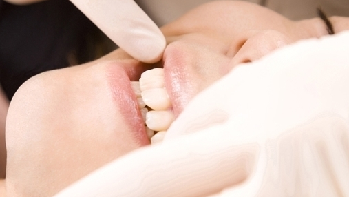 呉市中通の親知らずの抜歯・治療