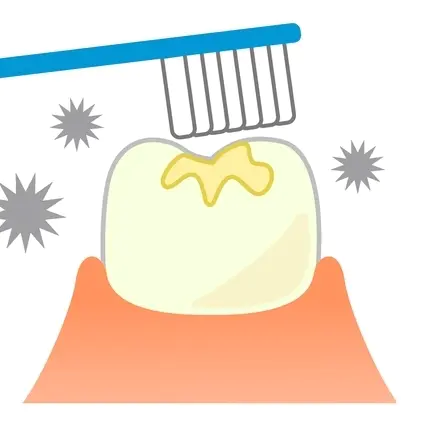 呉市中通のシーラント