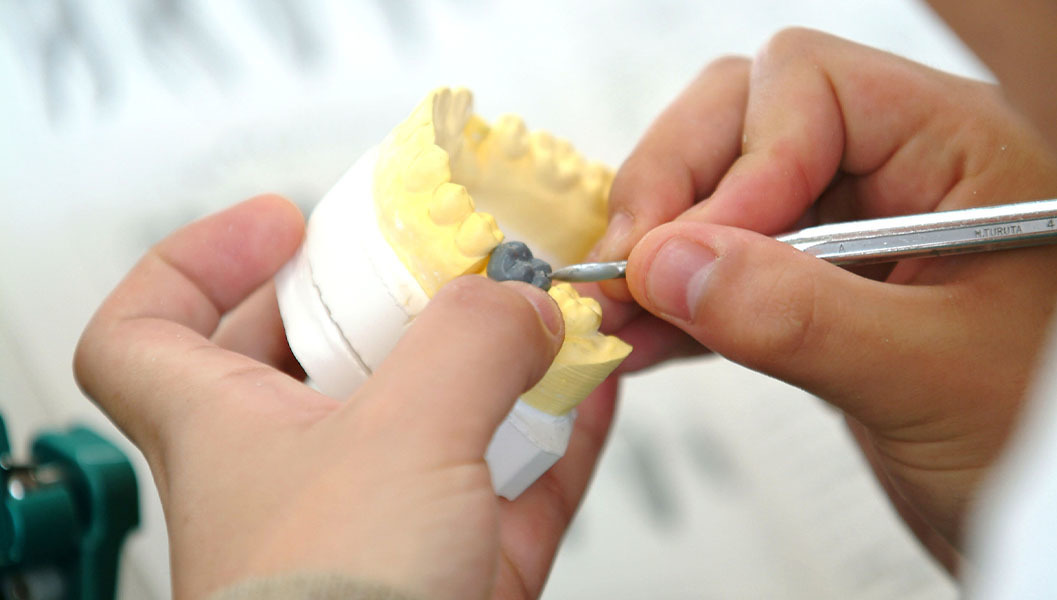 呉市中通の入れ歯治療