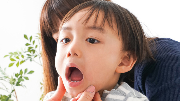 呉市中通の小児の予防歯科