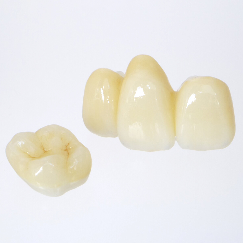 呉市中通のセレック1dayトリートメント