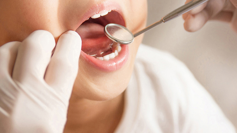 呉市中通の小児の予防歯科