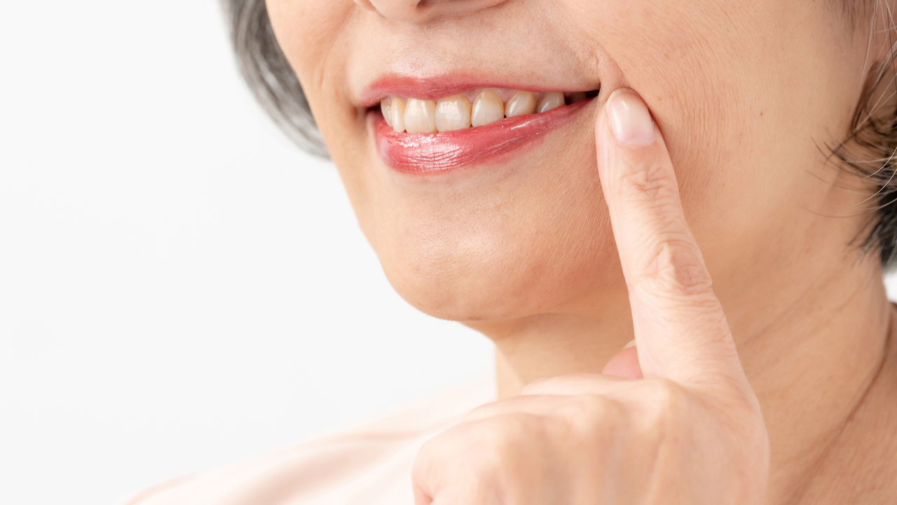 呉市中通の保険のノンクラスプデンチャー