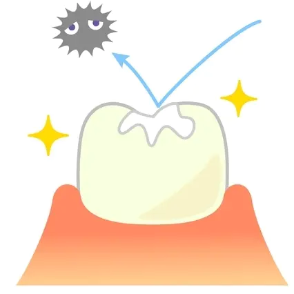 呉市中通のシーラント