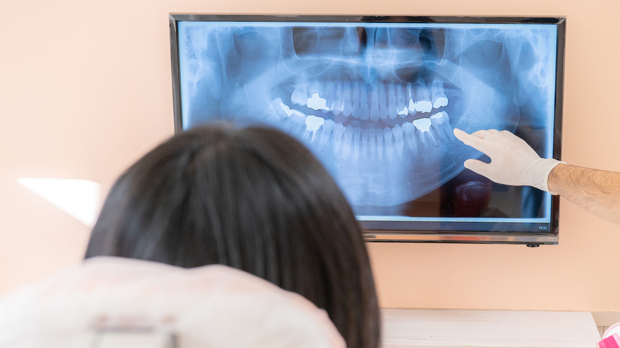 呉市中通の保険の入れ歯治療