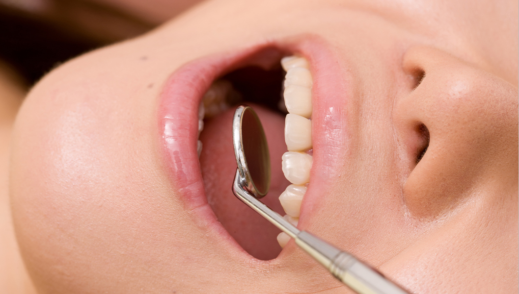 呉市中通の入れ歯治療