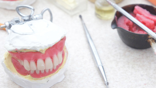 呉市中通の保険のノンクラスプデンチャー