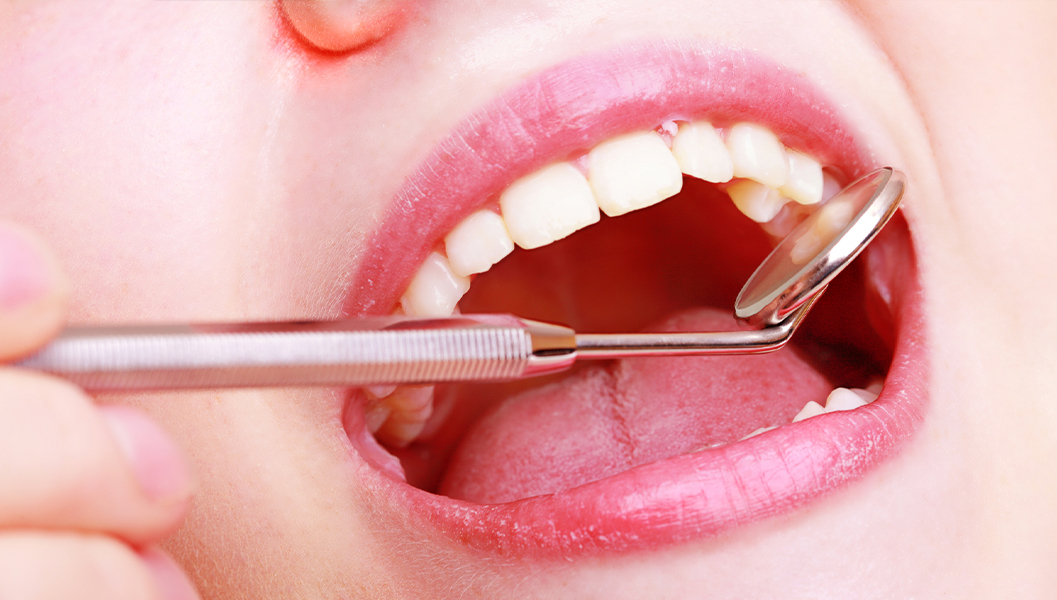 呉市中通の予防歯科・定期検診